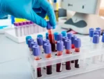 Best Blood Test