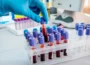 Best Blood Test